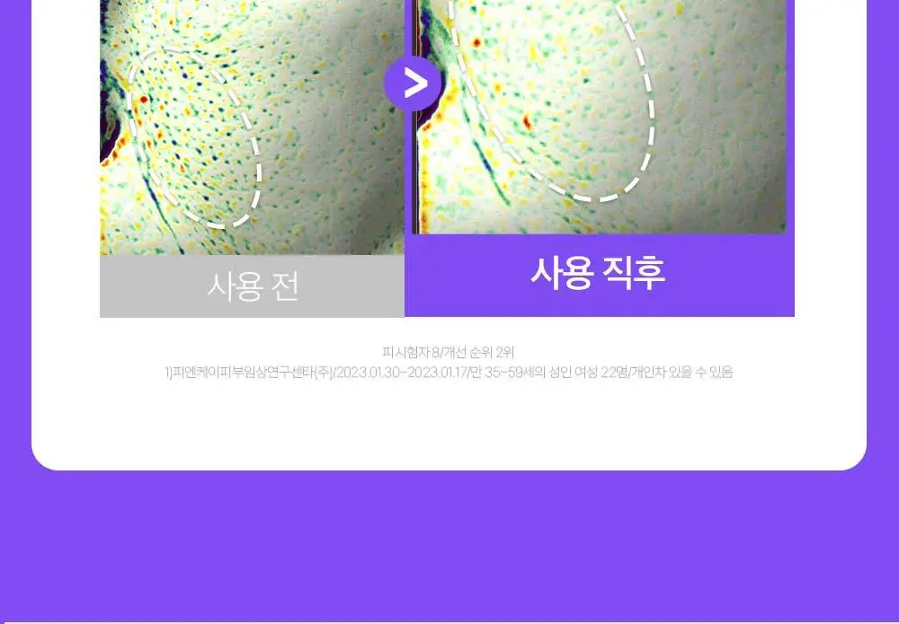 [나띠PICK][잡티케어] 더마펌 수딩 리페어 토닝 세럼 R4 30ml 기획 (+리필 30ml) 상세페이지 29
